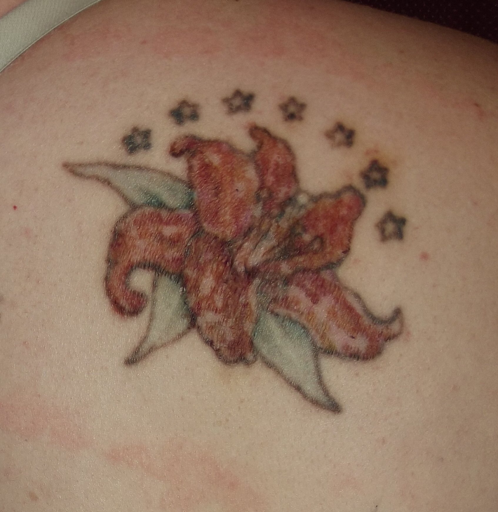 My Experience With R20 Laser Tattoo Removal